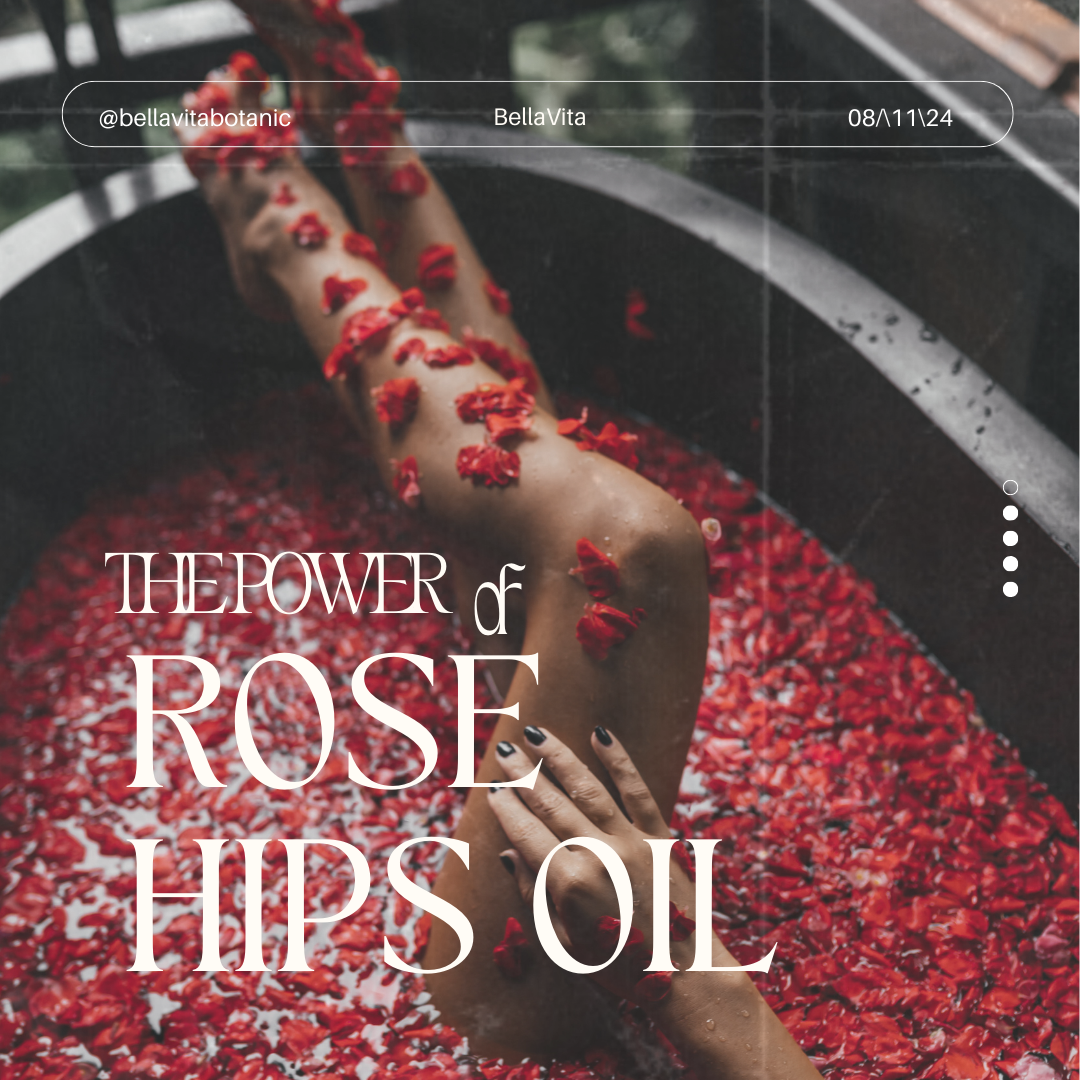 The Power of Rose Hips Oil – Our Key Ingredient in Every BellaVita Formula